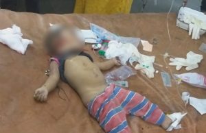 જામનગરમાં તળાવની પાળ પર હિટ એન્ડ રન,એક વર્ષની બાળકીનું કરૂણ મોત