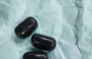 અમદાવાદ એરપોર્ટ પરથી મહિલા સહિત 3 લોકોના પેટમાંથી મળી સોનાની પેસ્ટની ‘કેપ્સુલ’!