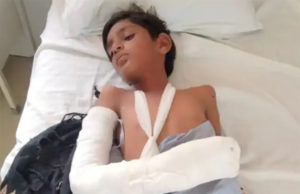 જૂની ફોનની બેટરીમાં બ્લાસ્ટ: બાળકની આંગળીઓ જ અલગ થતાં ઓપરેશન કરીને હથેળી જ કાપવી પડી, 200 મીટર સુધી સંભળાયો બ્લાસ્ટનો અવાજ!