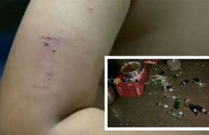 રાજકોટમાં પોલીસમેન-તેના મિત્રોની લુખ્ખાગીરી : કોન્સ્ટેબલે સાત મિત્ર સાથે ઇંડાં ખાધા, પૈસા માગ્યા તો બધાએ ભેગા થઈ 12 વર્ષના પુત્રને 14 ધોકા ફટકાર્યા!