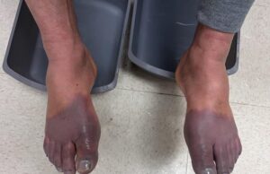 જીવના જોખમે કેનેડાથી અમેરિકામાં પ્રવેશતા 12 ભારતીયોનો બચાવ, ઠંડીમાં હિમ લાગવાથી ગંભીર હાલતમાં પીડાતા હતા